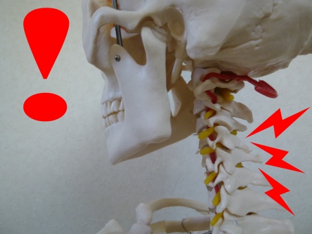 頸椎椎間板ヘルニアとはいったいなんでしょう？